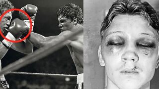 Цимент в ръкавиците и истината за най-жестокия мач в историята на бокса (ВИДЕО)