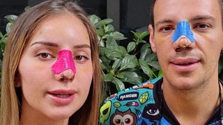 Алекс и Даниел Петканови споделиха, че са се подложили заедно на ринопластика (ВИДЕО)
