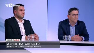 Снимка: Как да пазим сърцето си здраво?