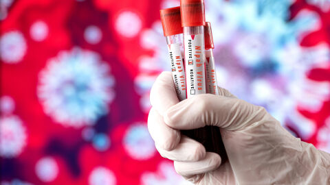 75% смъртност: Индийска медицинска сестра, заразена с вируса Нипа, почина