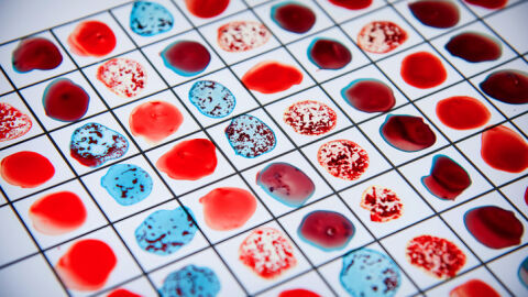 Само 50 души на Земята: Магията на най-рядката кръвна група в света