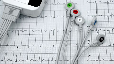 Защо случаите на инфаркт и инсулт се увеличават между Коледа и Нова година?