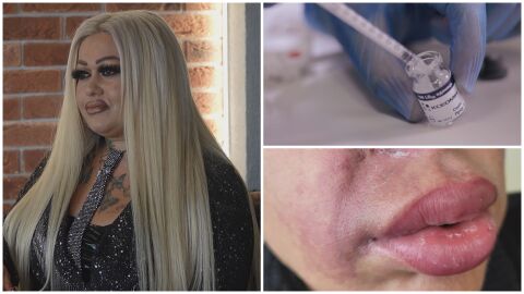 Дилъри на ботокс: Незаконна и опасна козметика от Азия залива българския пазар