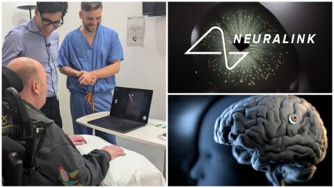 „Управлява компютър с мисълта си часове след операцията“: Имплантите на Мъск вече са в Европа