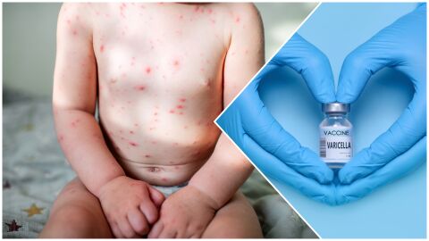 Задължителна ваксина срещу варицела: Вижте кога промяната влиза в сила 