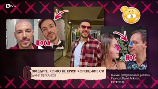 Топ 10 звездите, които не крият корекциите си