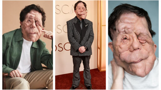 Снимка Адам Пиърсън: актьорът, който превърна различието си в сила и стигна до Оскарите