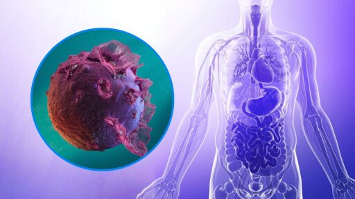 Вирус, причиняващ мононуклеоза, може да е причина за нелечимо автоимунно заболяване