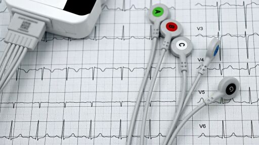 Защо случаите на инфаркт и инсулт се увеличават между Коледа и Нова година?