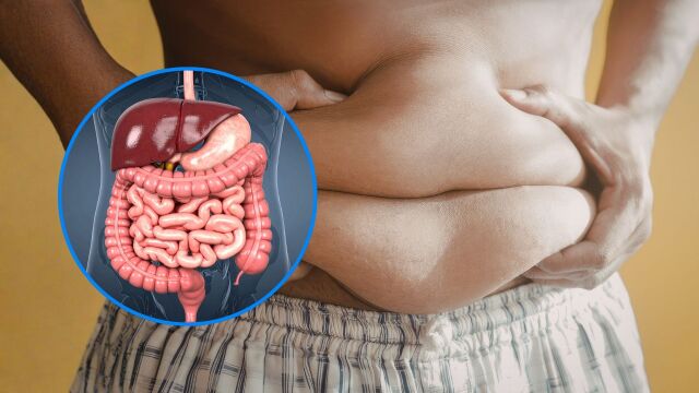 Снимка: Защо не може да отслабнете: Има скрита причина и тя се крие в червата