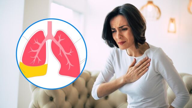 Снимка: Какви са симптомите на водния плеврит и как да го лекуваме