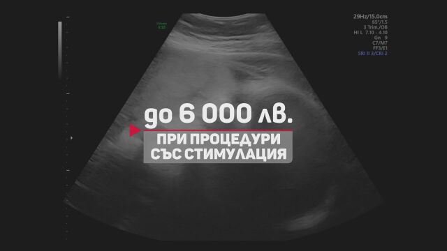 Заради остарели изисквания на инвитро фонда 1/3 от двойките финансират процедурите си сами