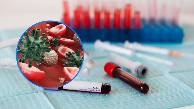 Снимка: Кръвен тест за рак открива множество заболявания с една проба