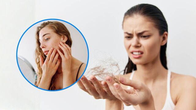 Снимка: Защо пролетта води до обилен косопад и по-чувствителна кожа