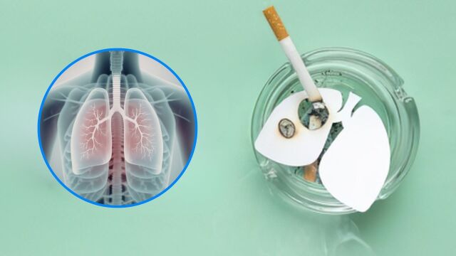 Снимка: Електронни цигари и тютюнопушене: Кое уврежда белите дробове най-много