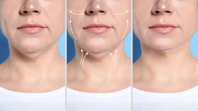 Снимка: 6 упражнения за премахване на двойна брадичка