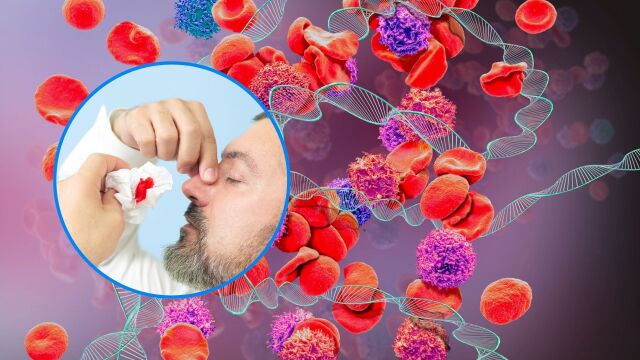 Снимка: Защо хемофилията засяга повече мъжете и кога става животозастрашаваща