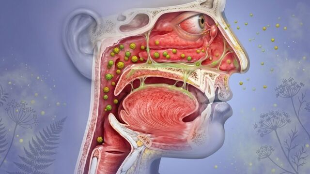 Снимка: Защо имунната система обявява война на полените и как да се защитите