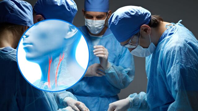 Снимка: Как се отпушва запушена сънна артерия