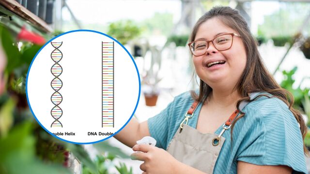 Снимка: Опитват да премахнат най-важната причина за Синдрома на Даун