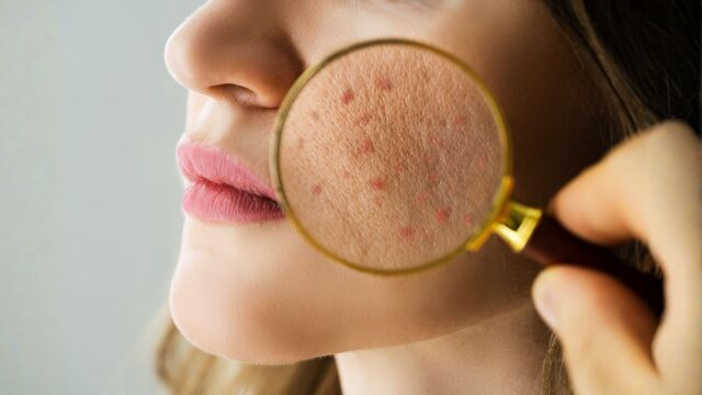 Снимка: Как да ускорим регенерацията на кожата за сияен тен без петна и бръчки