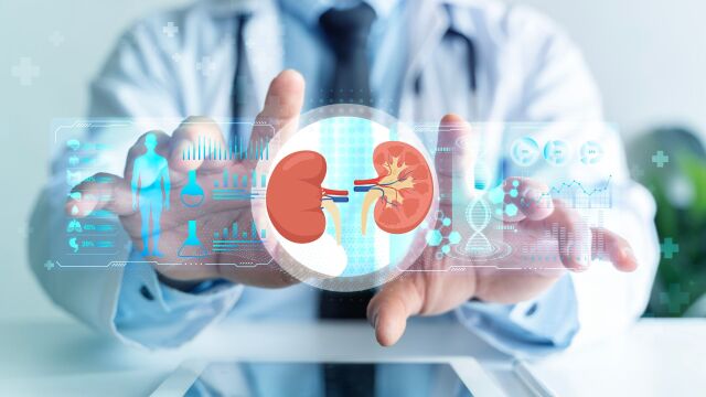 Снимка: Обикновена киста или поликистоза на бъбреците: Каква е разликата?
