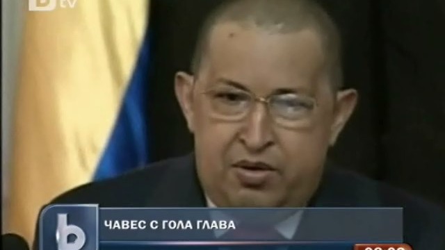 Снимка: Чавес се яви за пръв път пред публика без коса