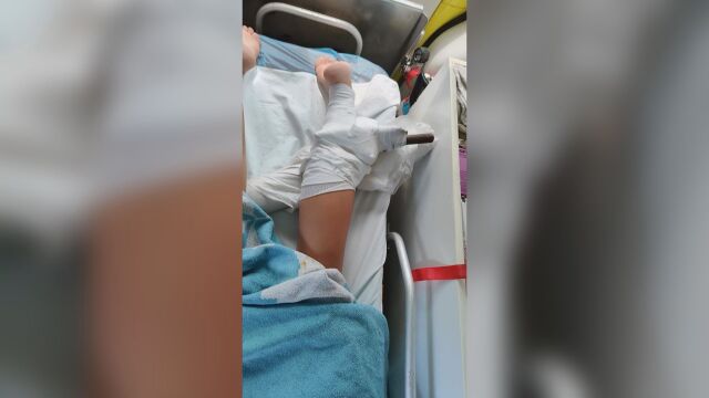 Дръжка от чадър се заби в крака на млада жена на плаж в Гърция