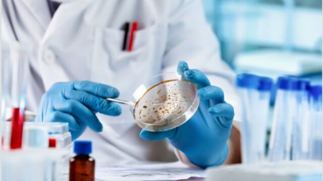 Снимка: Нов вид лекарства имат потенциала да лекуват опасни гъбични инфекции