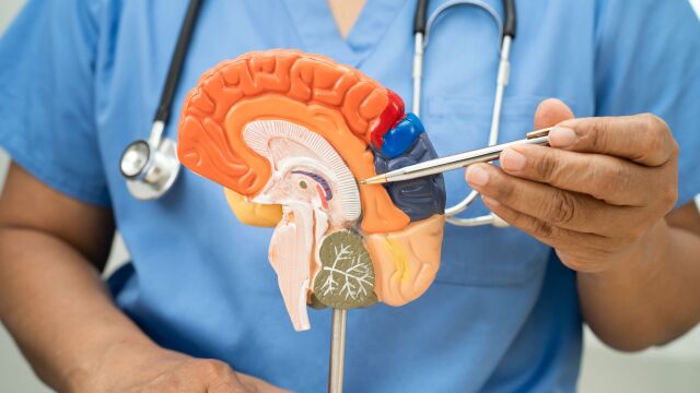 Снимка: 4 нови показателя предсказват риска от инсулт с 65% точност