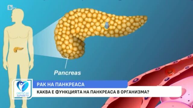 Снимка: Какви са постиженията в лечението на рака на панкреаса?