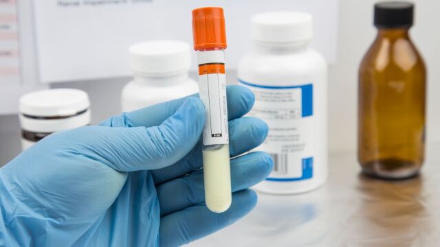 Снимка: Жени се подлагат напразно на инвитро заради нелекуван проблем при мъжете