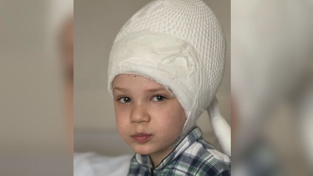 Снимка: 7-годишният Дима се нуждае от нова мозъчна операция (СНИМКИ)