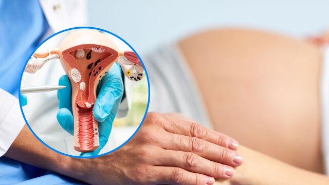 Снимка: Бременност с миома: Рискове и какво трябва да знаят жените