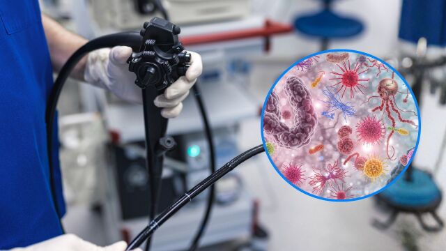 Снимка: Пробиотиции подпомагат възстановяването на червата след колоноскопия