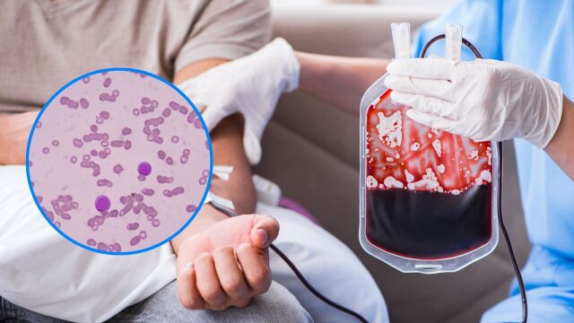 Снимка: Нова терапия за рак води до ремисия при пациенти със смъртоносна левкемия