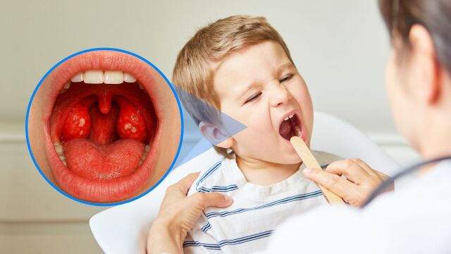 Снимка: Ангина: Защо някой деца боледуват по няколко пъти в годината?