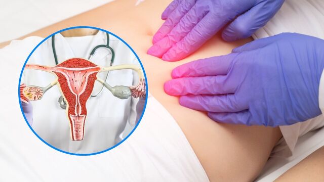 Снимка: Функционални кисти: Защо се появяват и кога изчезват сами