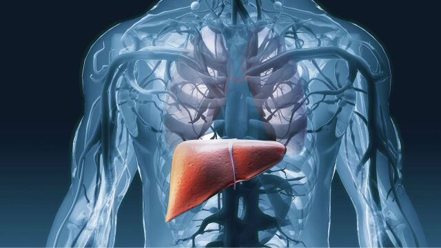 Снимка: Какво провокира омазняване на черния дроб при слаби хора