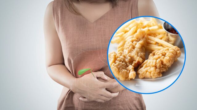 Снимка: 6 храни, които най-много дразнят жлъчката по празниците