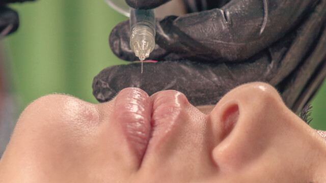 Снимка: Как да проверя дали дерматологът ми има лиценз за филъри и лазери? 