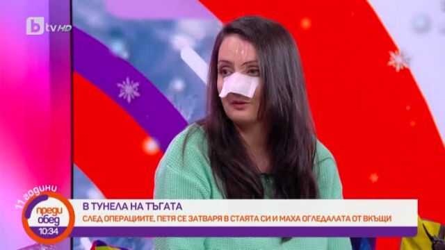 Снимка: Историята на Петя, обезобразена след ухапване от куче