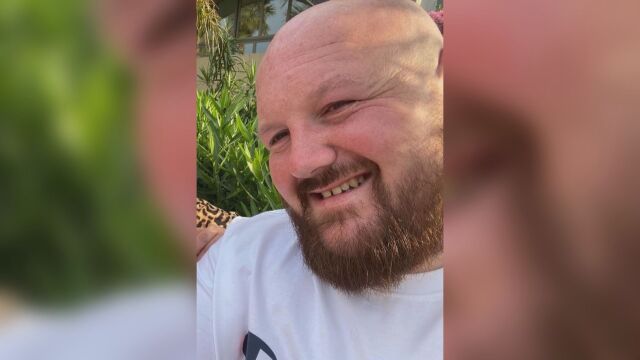 Мъж чието ляво око е било разядено след нападение с акумулаторна