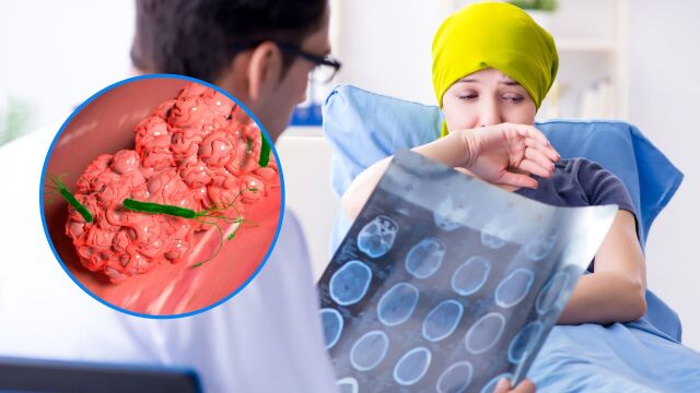 Снимка: 40% от раковите заболявания могат да бъдат предотвратени