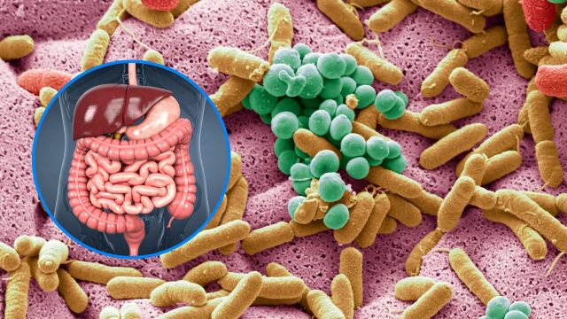 Снимка: Какво е инфекция с кампилобактер: Най-честото хранително отравяне в ЕС
