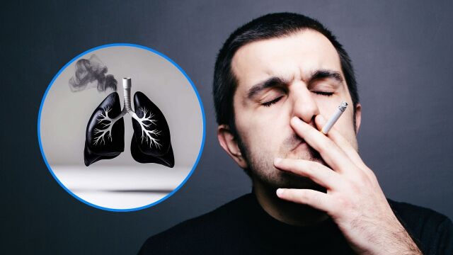 Снимка: Грип на пушачите: Кога се появява и как можете да се справите