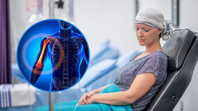 Снимка: Рак на костите: Какво „скрива” диагнозата и как се лекува