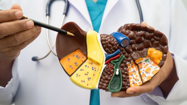 Снимка: Промяна в диетата може да забави рак на черния дроб