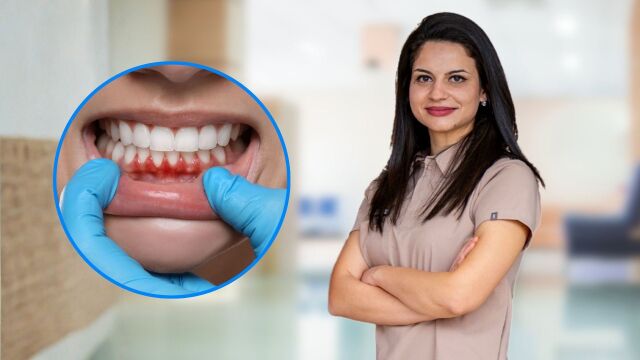 Снимка: Д-р Хараламбиева: Кървящите венци не са безобидни