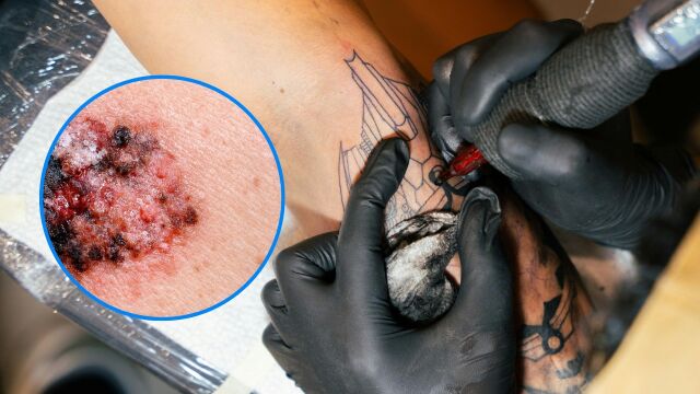 Снимка: Могат ли татуировките да са причина за рак? 